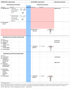 Női genitális traktus anomáliáinak osztályozása Táblázat a női genitális traktus anomáliáinak osztályozásáról ESHRE/ESGE, AFS/ASRM és klasszikus besorolás szerint.