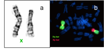 Kromoszóma mikroszkópos képe és fluoreszcens festés Kromoszóma mikroszkópos képe és fluoreszcens festéssel jelölt Xq és Xp karok.