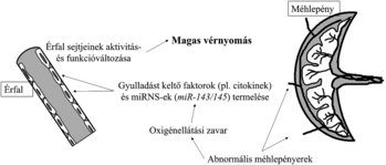 Magas vérnyomás hatása az érfalra és méhlepényre Diagram a magas vérnyomás hatásairól az érfal és méhlepény működésére, gyulladást keltő faktorok termelése és oxigénellátási zavarok.