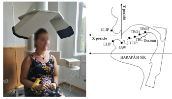Orvosi eszköz fogászati vizsgálathoz és száj anatómiai diagram Orvosi eszköz fogászati vizsgálathoz, személy használja, száj anatómiai diagram a pozíciókkal