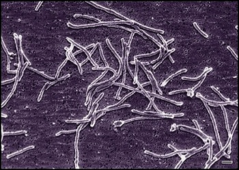 Streptomyces baktériumok elektronmikroszkópos képe Elektronmikroszkópos felvétel Streptomyces baktériumok szálas szerkezetéről.