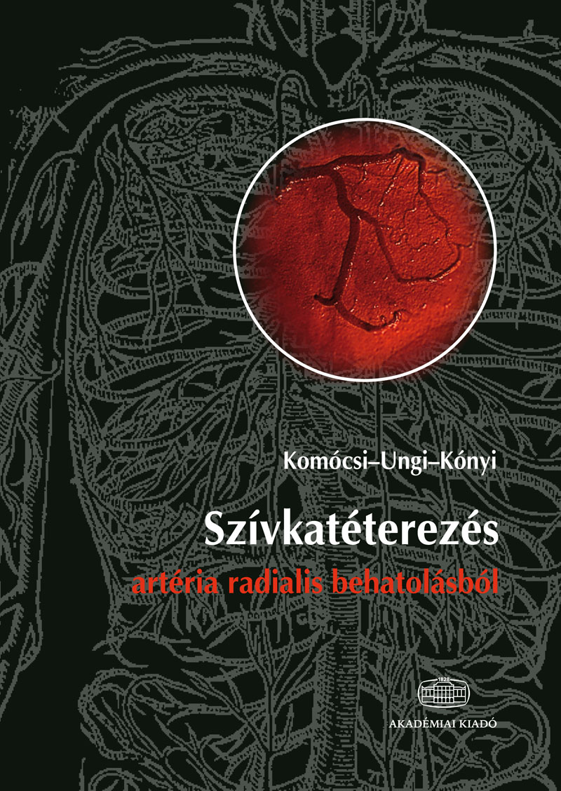 Szívkatéterezés artéria radialis behatolásból