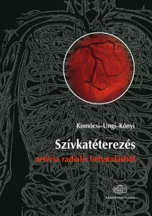 Szívkatéterezés artéria radialis behatolásból
